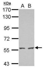 ATG13 Antibody in Western Blot (WB)