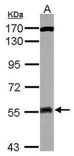 ATG13 Antibody in Western Blot (WB)