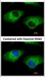 ALDH1A1 Polyclonal Antibody