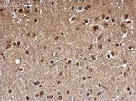 FHL1 Polyclonal Antibody