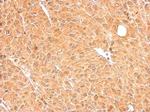 GALM Polyclonal Antibody