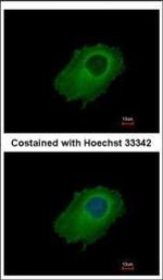 SERPINE2 Polyclonal Antibody