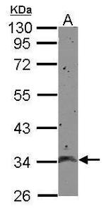 CCDC90A Polyclonal Antibody