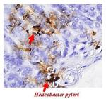 Helicobacter pylori Urease B Polyclonal Antibody