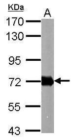 Helicobacter pylori Urease B Polyclonal Antibody