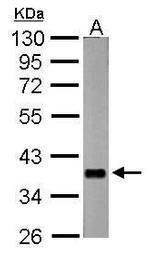 nrv2 Polyclonal Antibody