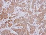 ZPK Polyclonal Antibody