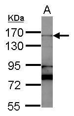RAD50 Polyclonal Antibody