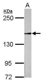 RAD50 Polyclonal Antibody