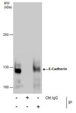 E-cadherin Antibody in Immunoprecipitation (IP)
