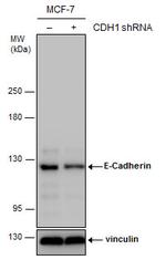 E-cadherin Antibody in Western Blot (WB)