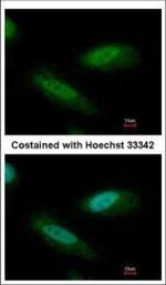 CHD4 Polyclonal Antibody