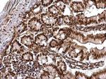 CHD4 Antibody in Immunohistochemistry (Paraffin) (IHC (P))