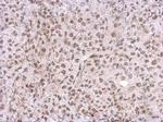 CHD4 Antibody in Immunohistochemistry (Paraffin) (IHC (P))