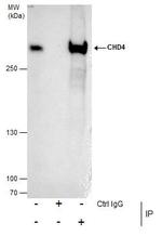 CHD4 Antibody in Immunoprecipitation (IP)