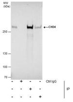 CHD4 Antibody in Immunoprecipitation (IP)