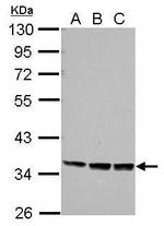 PRR5 Polyclonal Antibody