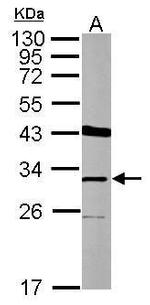THAP11 Polyclonal Antibody