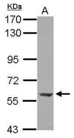 PLAG1 Antibody in Western Blot (WB)