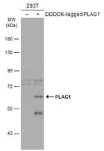 PLAG1 Antibody in Western Blot (WB)