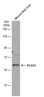 PLAG1 Antibody in Western Blot (WB)