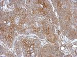 DZIP3 Polyclonal Antibody