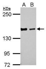 DZIP3 Antibody in Western Blot (WB)