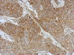 DZIP3 Polyclonal Antibody