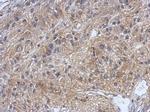 DZIP3 Polyclonal Antibody