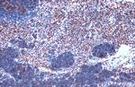 JMJD3 Polyclonal Antibody