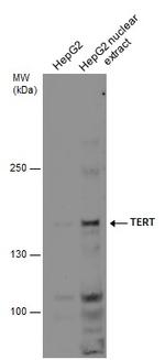 TERT Polyclonal Antibody