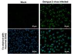 Dengue Virus Type 2 NS2B Antibody in Immunocytochemistry (ICC/IF)