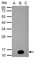 Dengue Virus Type 2 NS2B Antibody in Western Blot (WB)