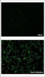 Dengue Virus Type 2 NS4B Antibody in Immunocytochemistry (ICC/IF)