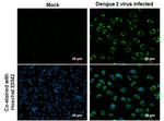 Dengue Virus Type 2 NS4B Antibody in Immunocytochemistry (ICC/IF)