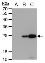 Dengue Virus Type 2 NS4B Antibody in Western Blot (WB)
