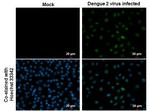 Dengue Virus Type 2 NS5 Antibody in Immunocytochemistry (ICC/IF)