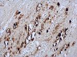 Enterovirus 71 Antibody in Immunohistochemistry (Paraffin) (IHC (P))