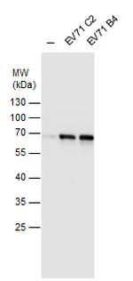 Enterovirus 71 Antibody in Western Blot (WB)
