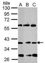 NeuroD1 Polyclonal Antibody
