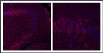 GLI1 Antibody in Immunohistochemistry (Paraffin) (IHC (P))