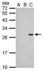 Japanese Encephalitis Virus NS4B Antibody in Western Blot (WB)