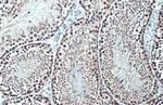 TET1 Antibody in Immunohistochemistry (Paraffin) (IHC (P))