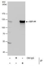 GEF-H1 Antibody in Immunoprecipitation (IP)