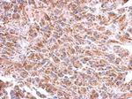 ST8SIA4 Polyclonal Antibody