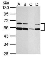 ST8SIA4 Antibody in Western Blot (WB)