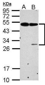 EPCR Polyclonal Antibody