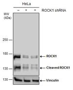 ROCK1 Polyclonal Antibody