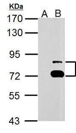 TTC39B Antibody in Western Blot (WB)