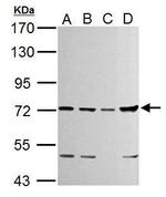 TTC39B Antibody in Western Blot (WB)
